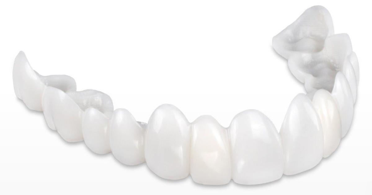 Snap-On Smile® is a non-invasive cosmetic, removable full or partial arch that literally snaps right over the patient's existing dentition without impinging on the gingival tissue or covering the palate.