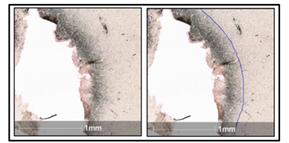 ClearPoint Neuro Announces FDA Clearance of the SmartFrame Array