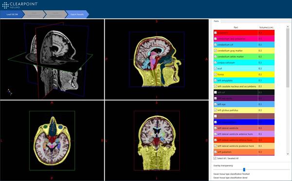 ClearPoint Maestro Brain Model Screenshot
