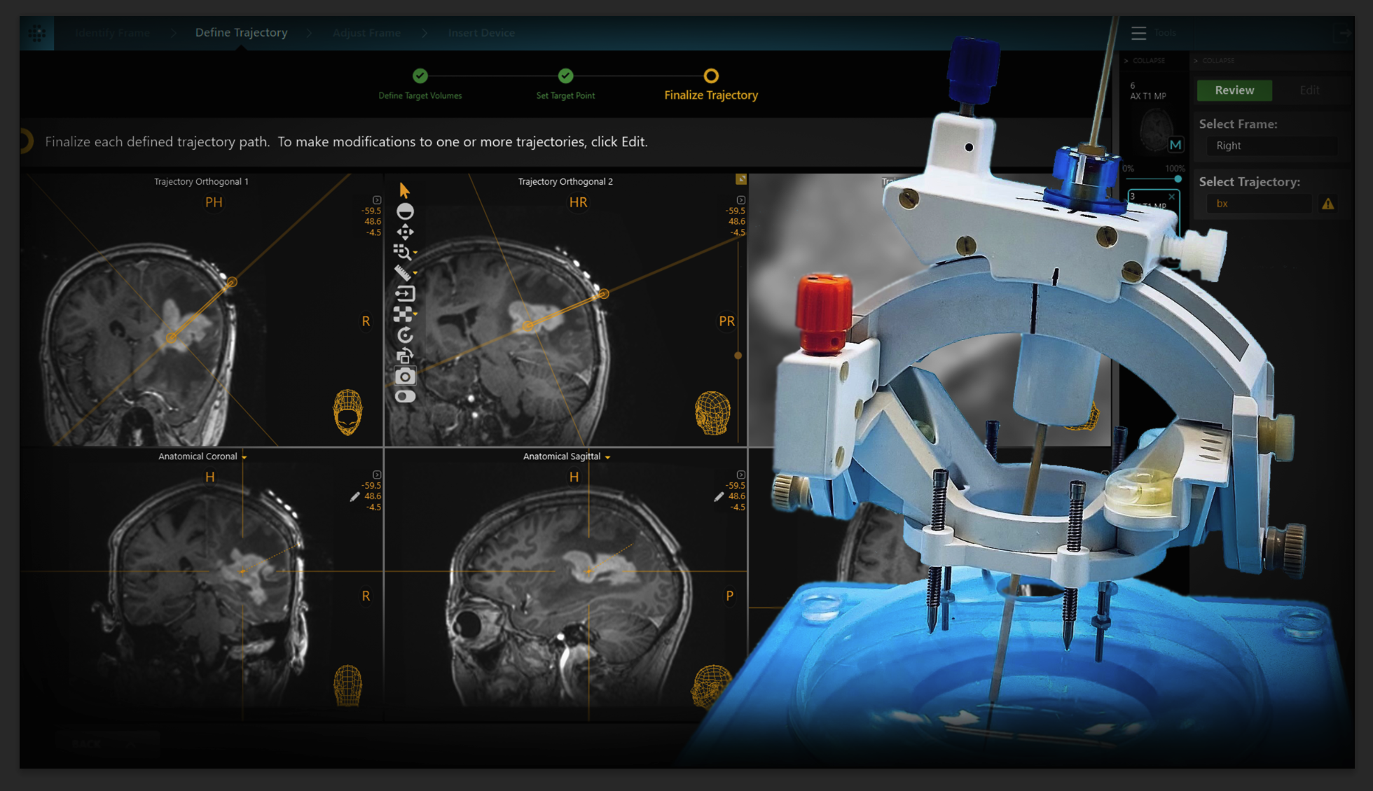 ClearPoint Neuro