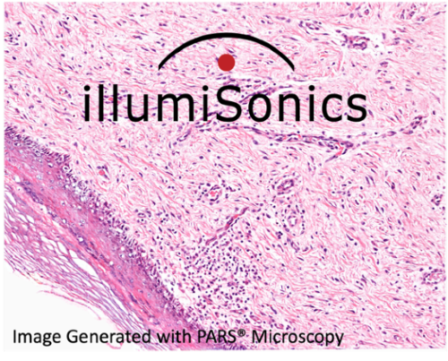 PARS H&E Image