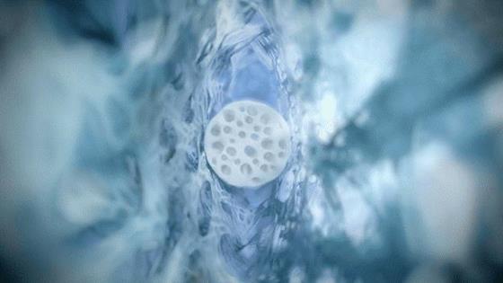 The AlloSpan Canal Bio-Scaffold: AlloSpan Canal naturally expands on average by ~2.5x with hydration in the canal and is tailored to retain canal restoration and dilation.