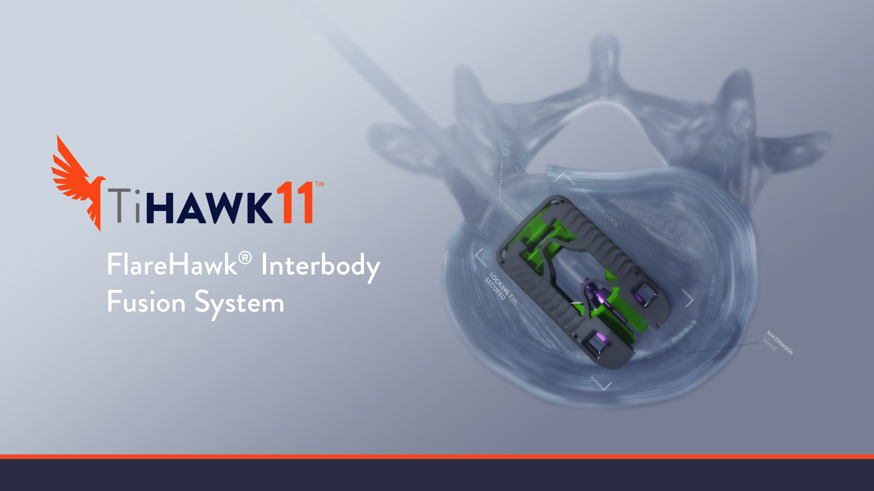 Accelus recently received U.S. FDA 510(k) Clearance for its TiHawk11, the latest addition to its FlareHawk portfolio of expandable interbody fusion devices.