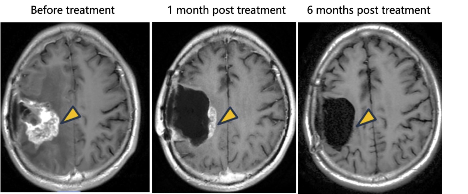 NeuExcell Therapeutics