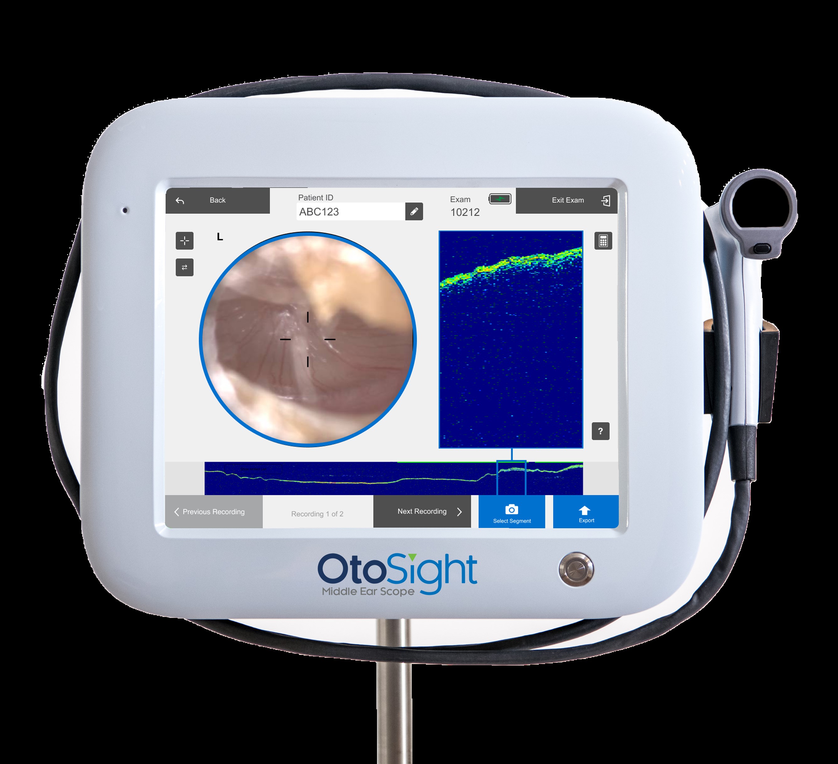 PhotoniCare OtoSight™ Middle Ear Scope