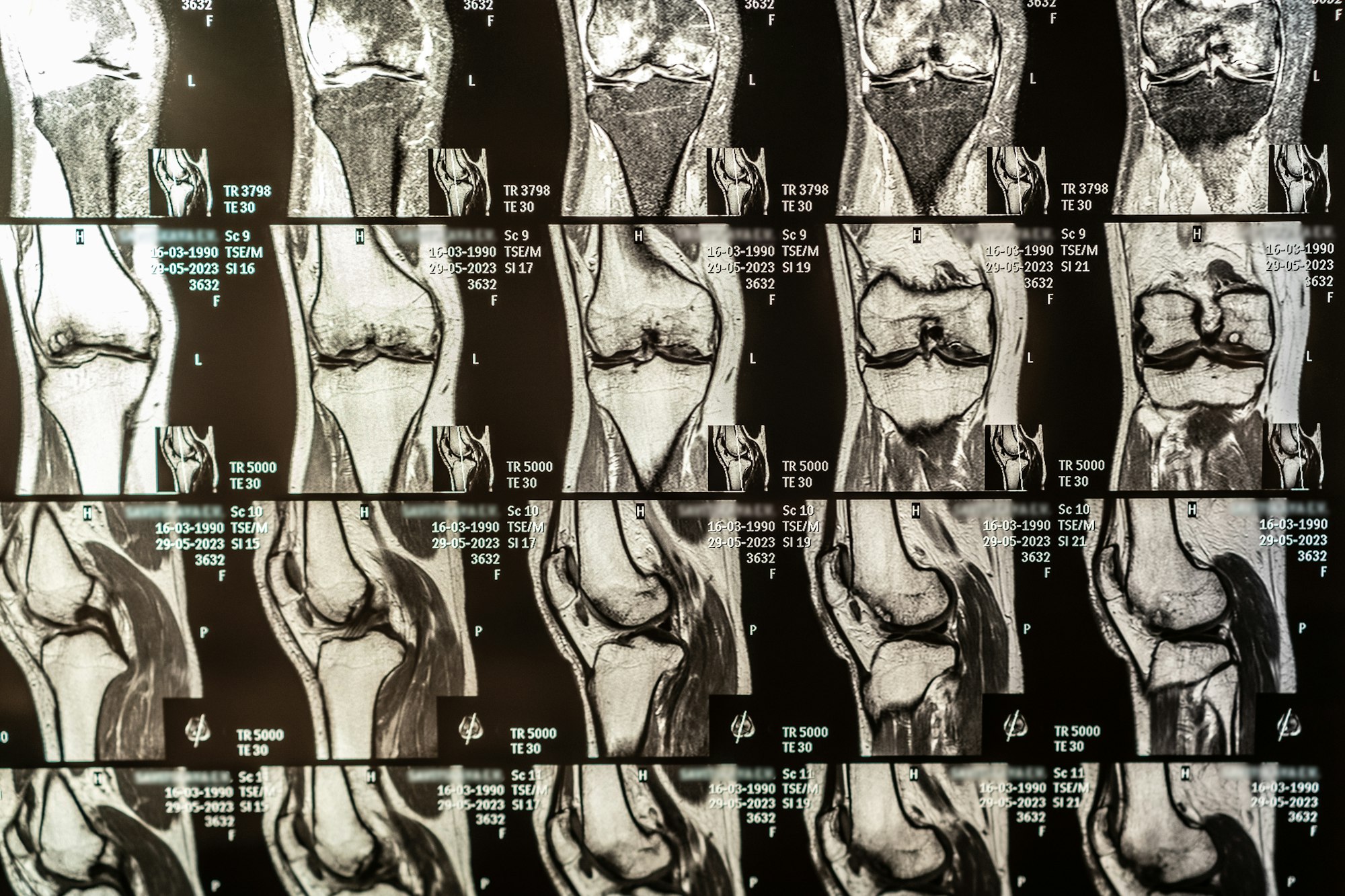 Orthofix Medical Inc. Class Action Lawsuit