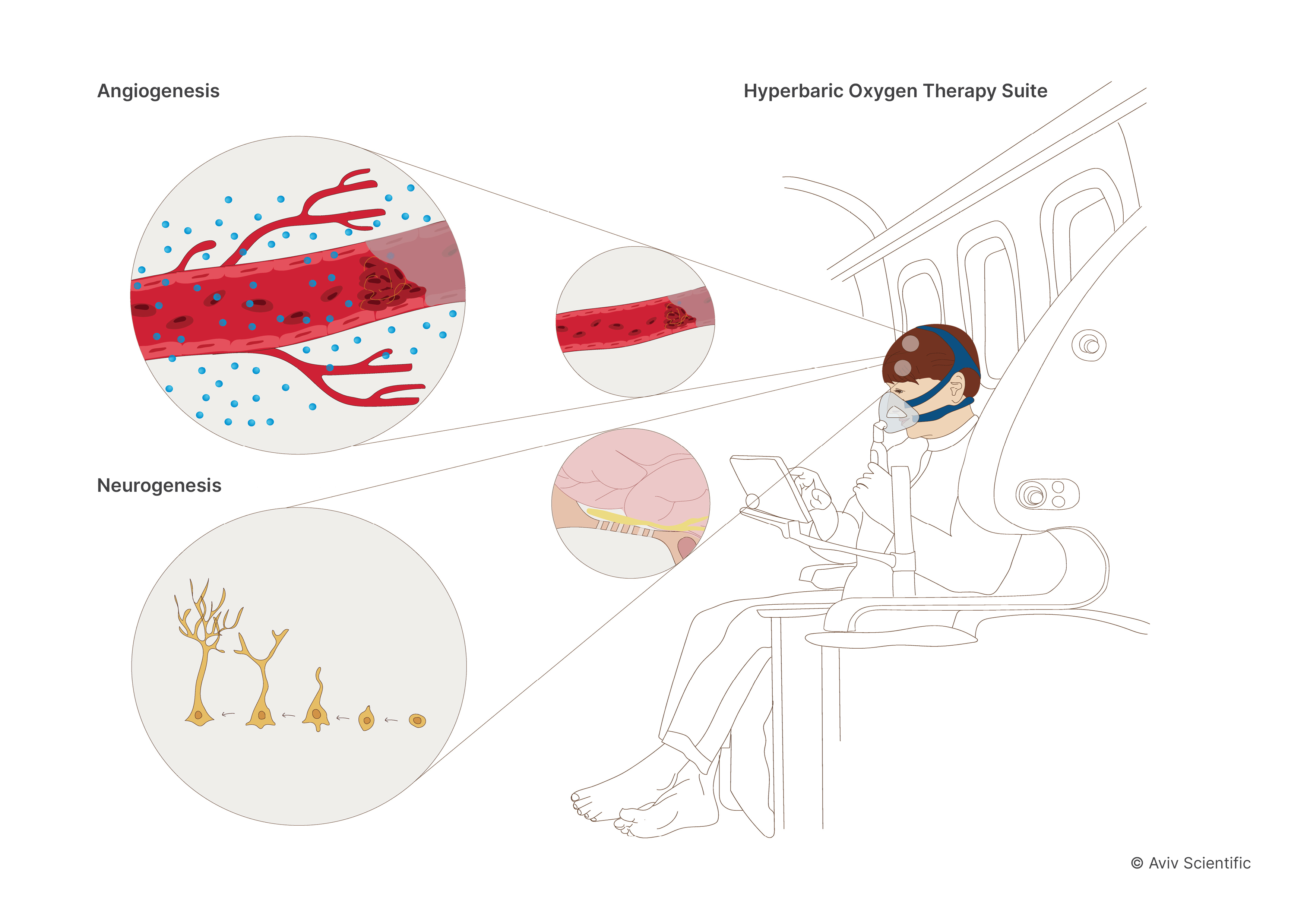 hbot-impact-on-brain-of-long-covid-aviv