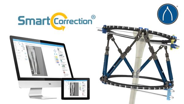 The WishBone Medical Smart Correction® System 