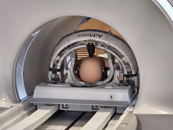 AiM Medical Robotics' MRI-compatible stereotactic frame integrated with an MRI scanner, showcasing the setup used for precise, real-time guided neurosurgical procedures.