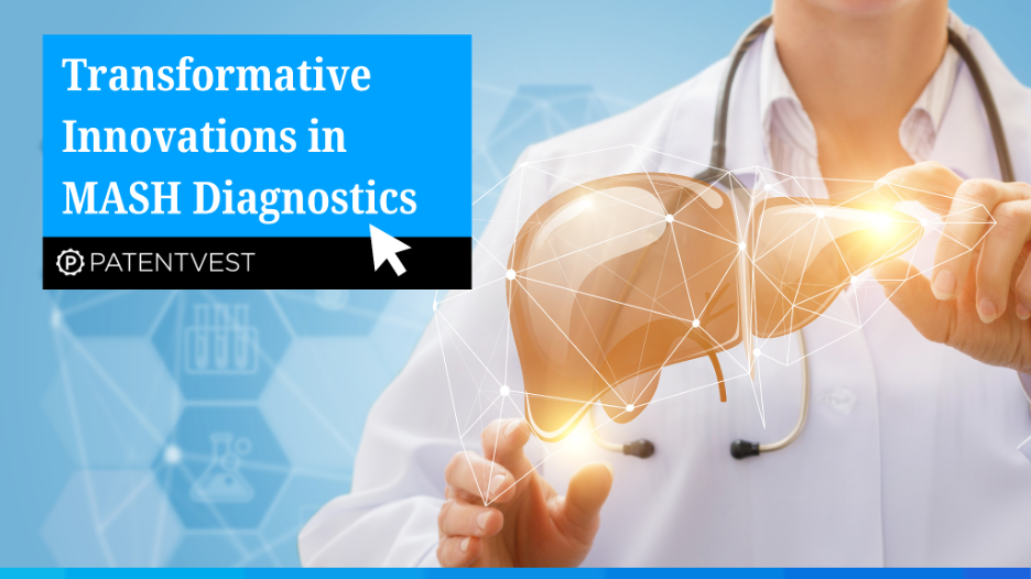 Transformative Innovations in MASH Diagnostics