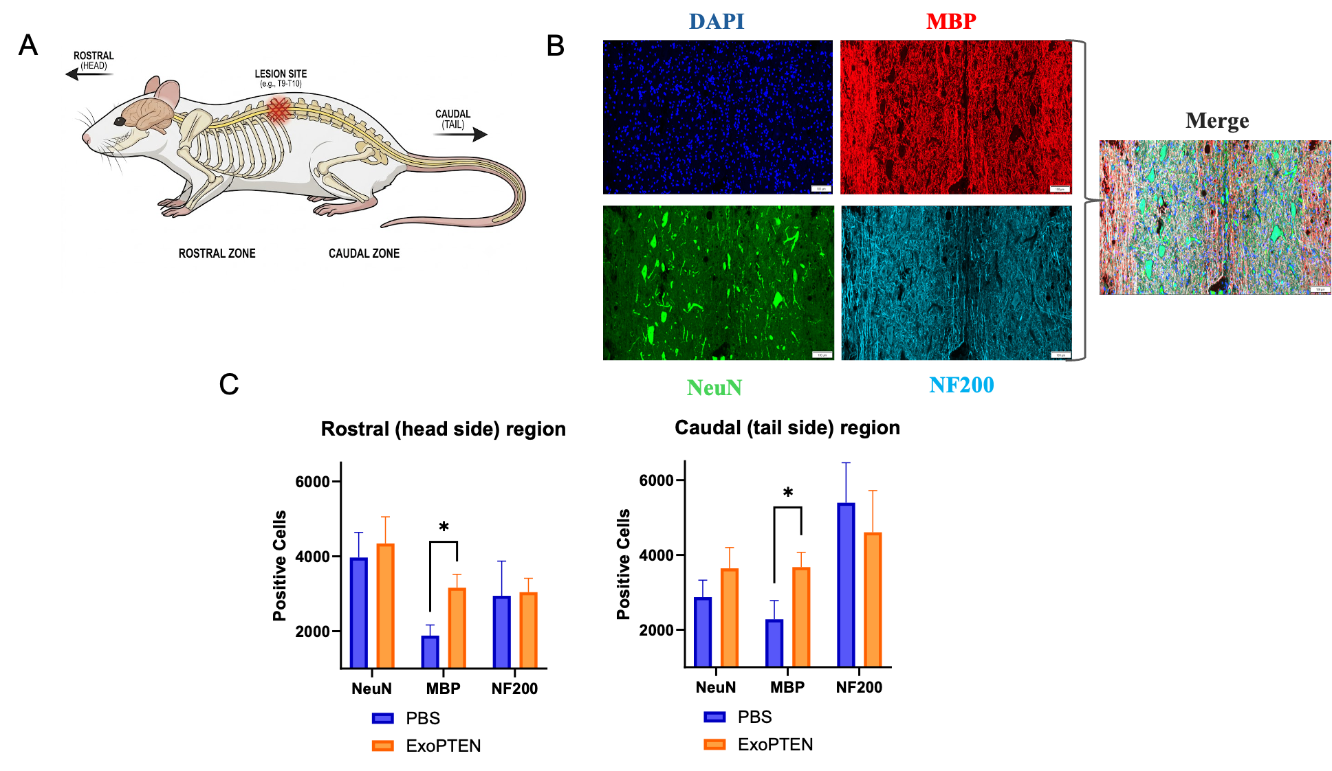 NurExone Reports New Preclinical Tissue-Analysis Data Supporting Potential Neuroprotective Effect of ExoPTEN in Acute Spinal Cord Injury Animal Model