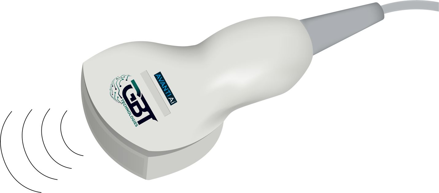 GBT Commences Research on an External Device for Arterial Clogs and Tissue Imaging Based on its Proprietary Radio Technology thumbnail