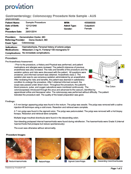 Provation MD sample electronic procedure note for a screening colonoscopy with endoscope images and anatomical diagram.