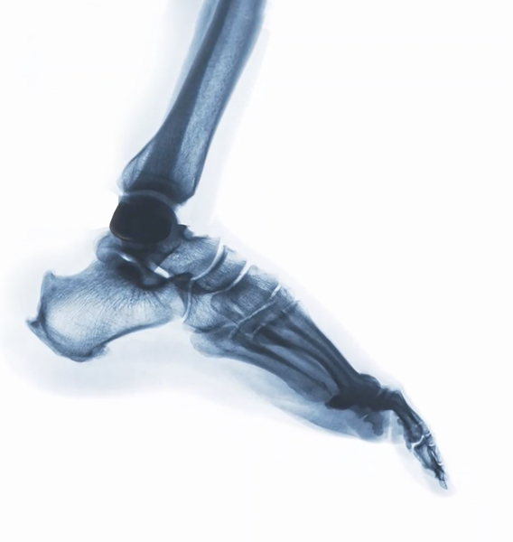 DDR for orthopedic and MSK applications