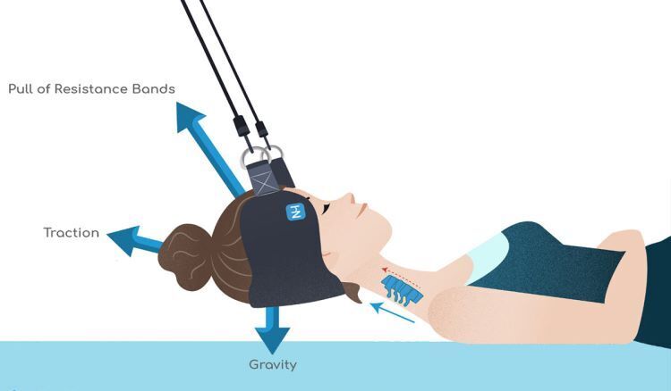 The Neck Hammock is a cervical traction device designed for anyone experiencing mobility problems, neck pain, and tension. It has brought relief to millions of users. Check out our review.