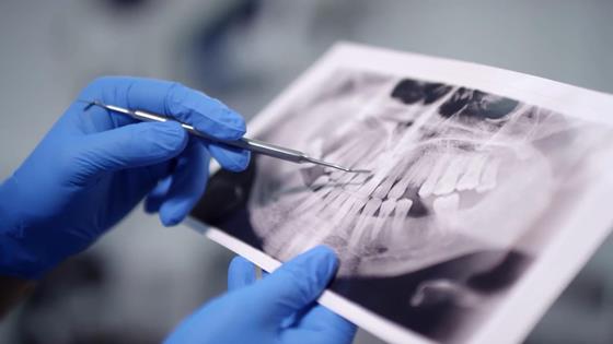 Many Americans Want to Keep Their Natural Teeth—But Aren’t Taking the Right Steps: May is Save Your Tooth Month—a reminder that proactive care and the right dental specialist can make all the difference. Whether you're managing discomfort or just trying to protect your smile, it starts with prevention and timely care.