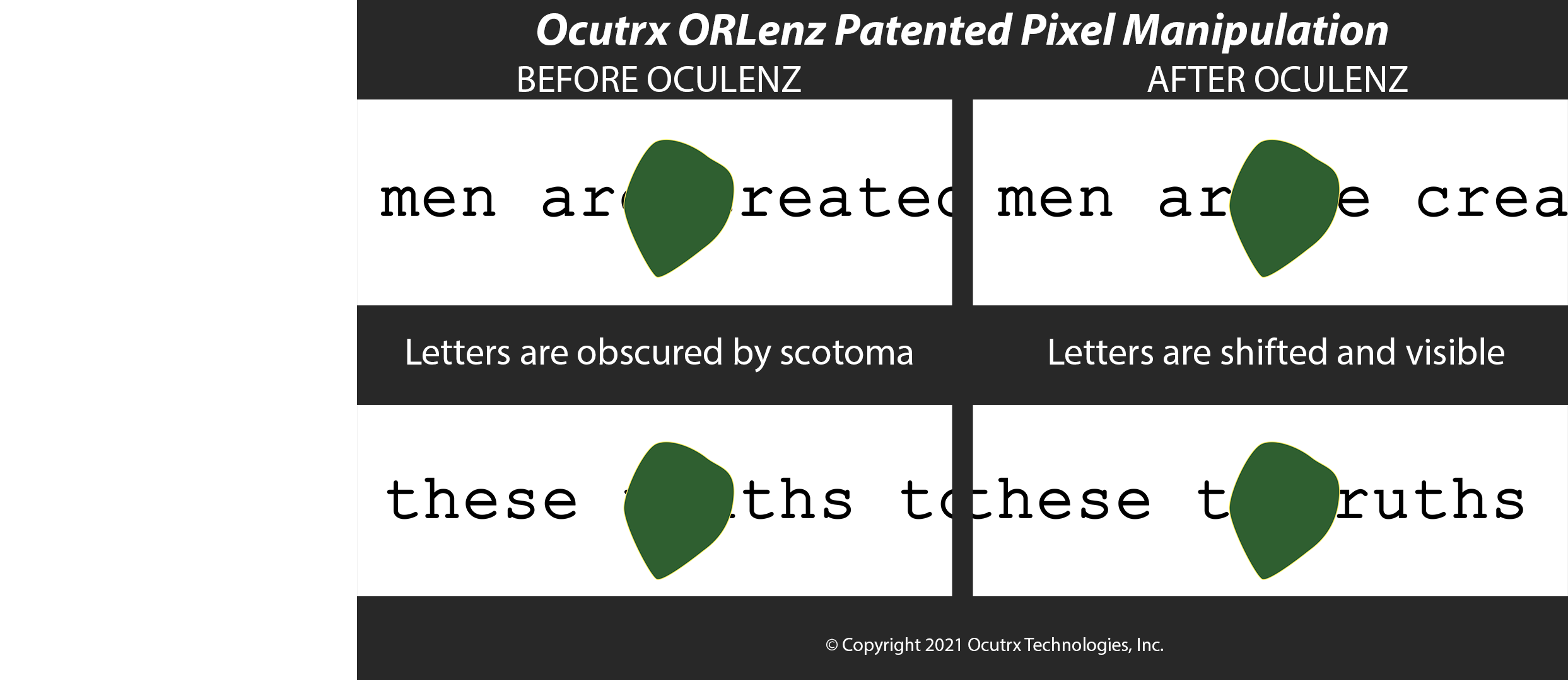 Ocutrx Vision Technologies Continues to Innovate in the AR