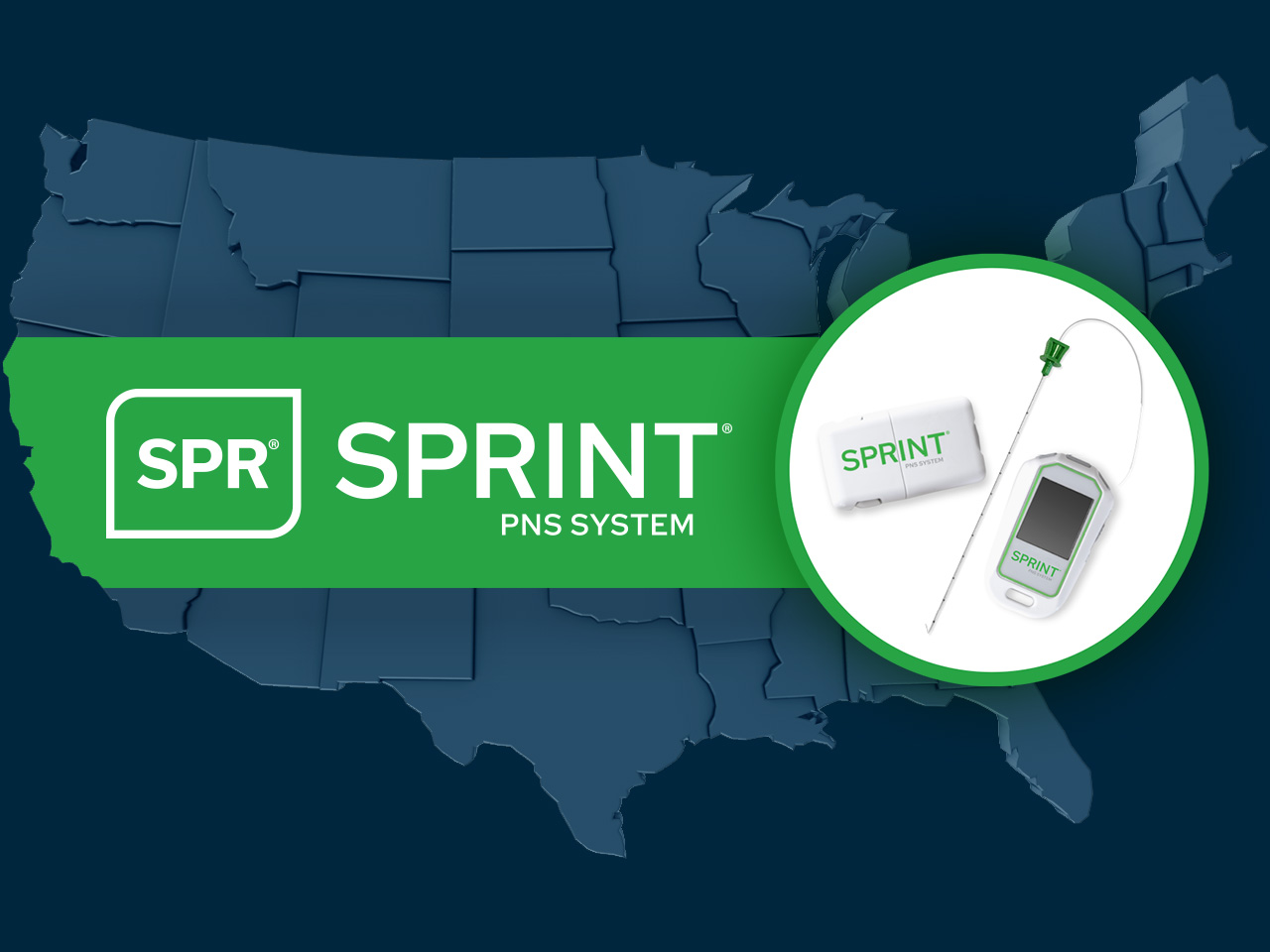 SPR announces national coverage of SPRINT PNS