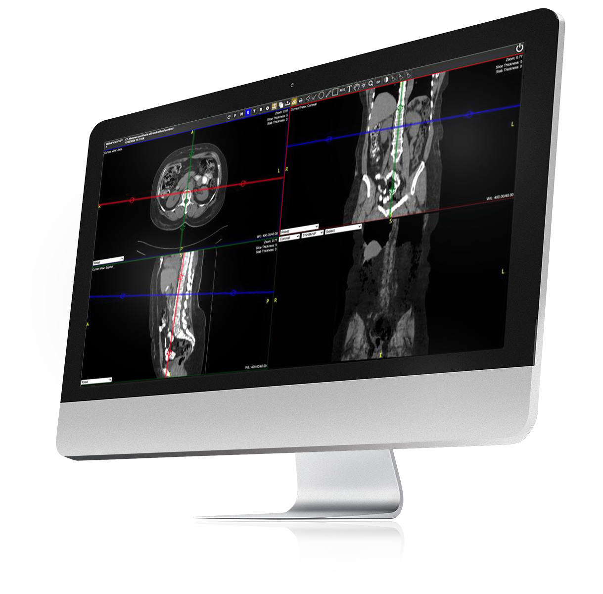 Exa New Version Monitor Comp Apr25