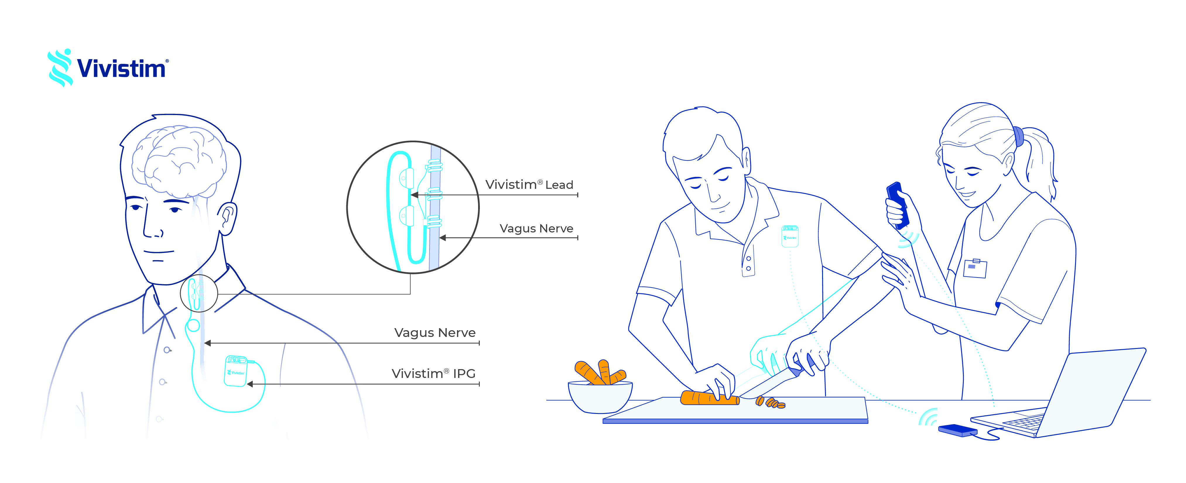 Vivistim Paired VNS Therapy Illustration-Combo
