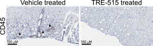 Representative stained spinal cord sections from a mouse ADEM model. Arrows point to regions of leukocyte infiltration.