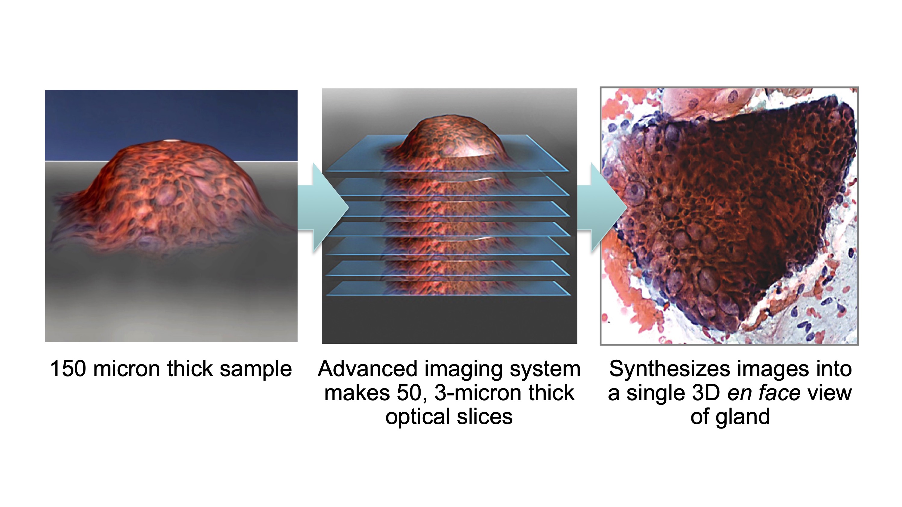 WATS3D imaging