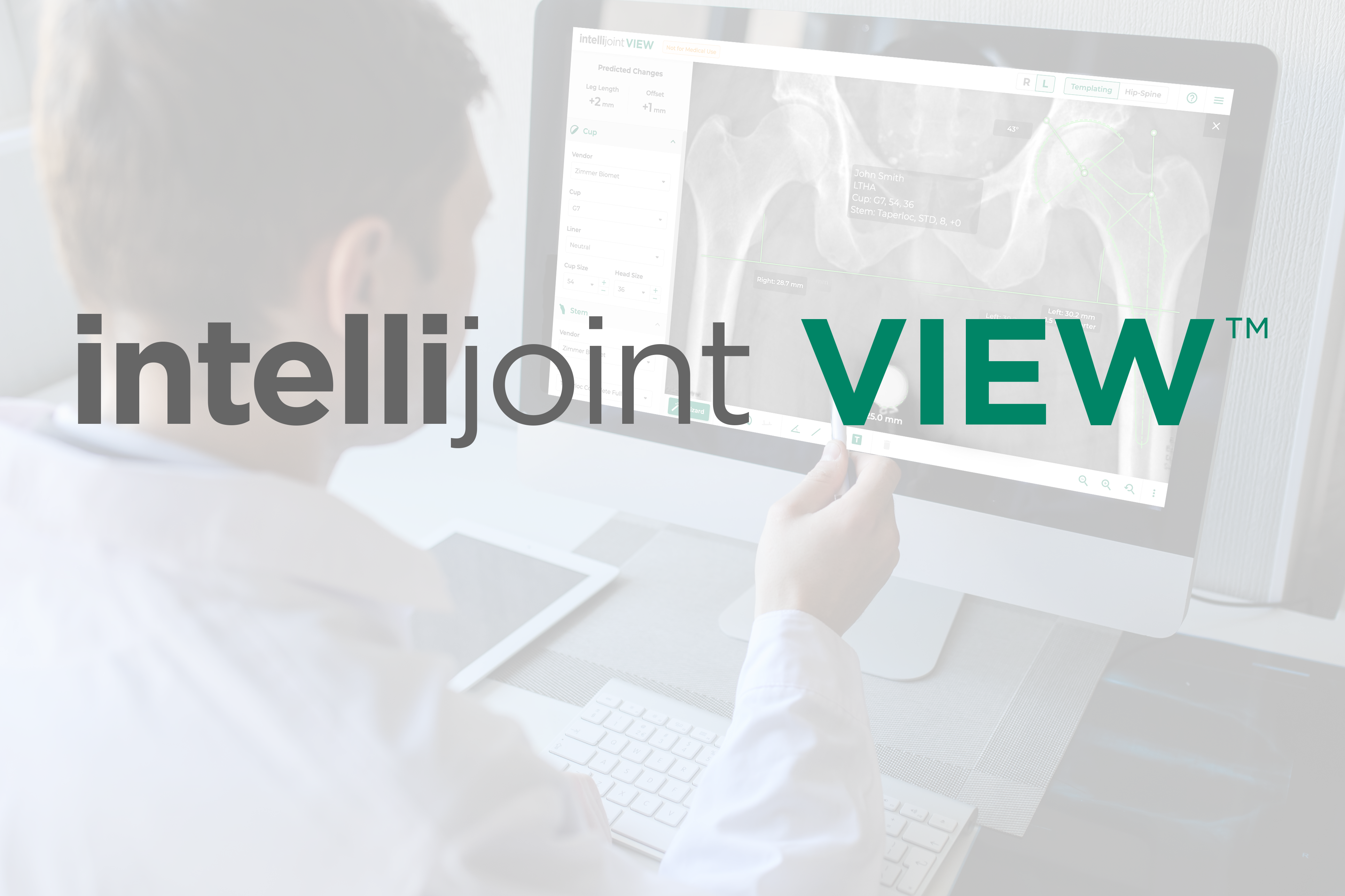 Intellijoint View