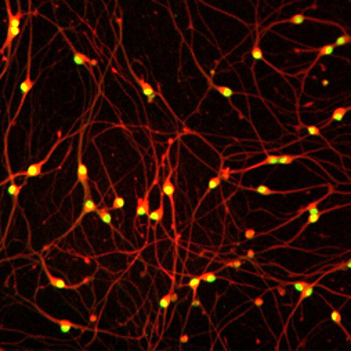 iCell Sensory Neurons