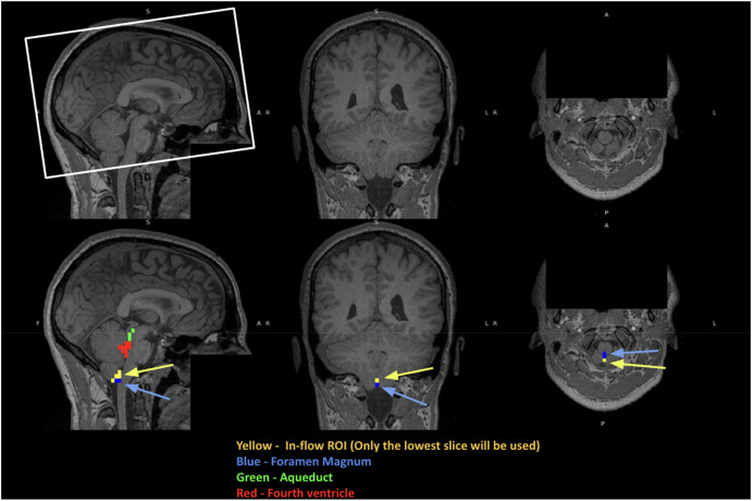 Regions of interest.