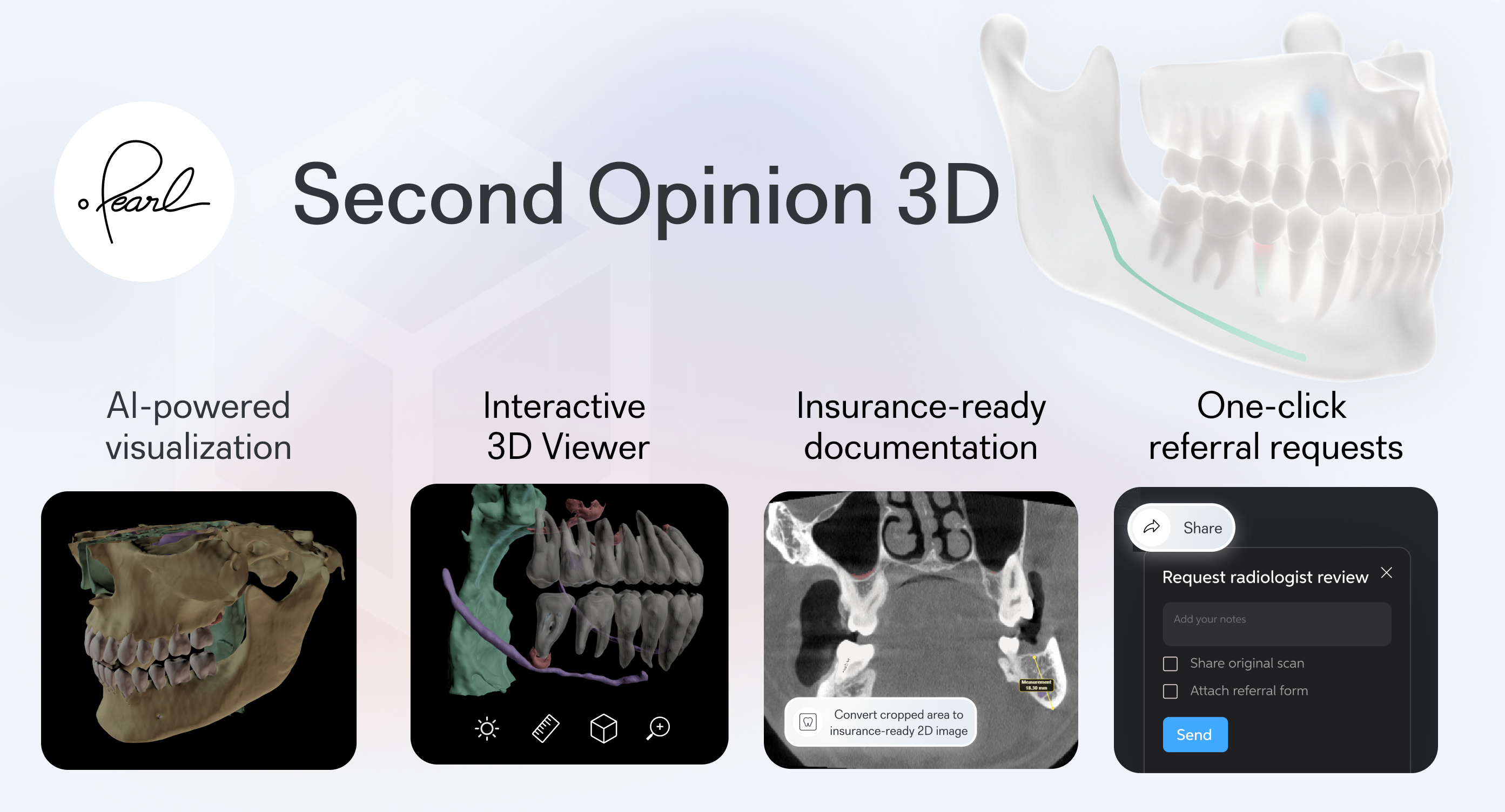 Pearl Second Opinion 3D - Key Features