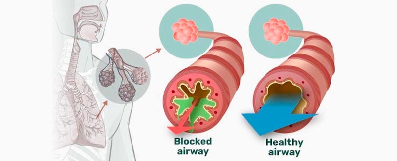AirPhysio Features.jpeg