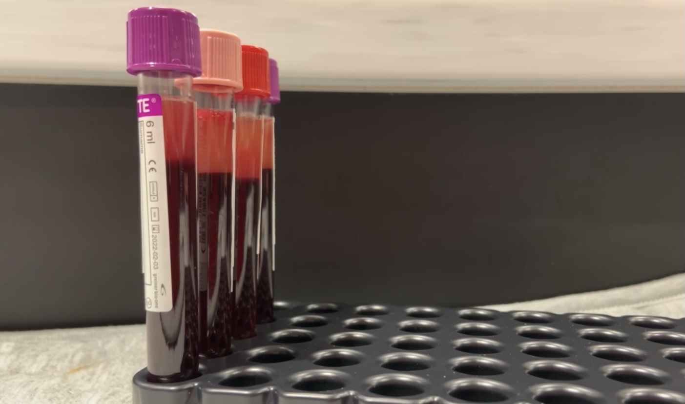 TBC has implemented a new COVID-19 antibody screening that will test each donor’s blood to see if it contains the antibodies from the COVID-19 vaccine and/or antibodies from exposure to the COVID-19 virus. 