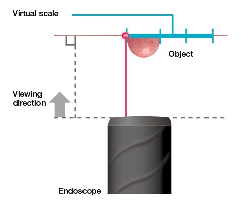 The laser point needs to be positioned on the left hand side of the lesion and the virtual scale will be displayed on the right hand side.