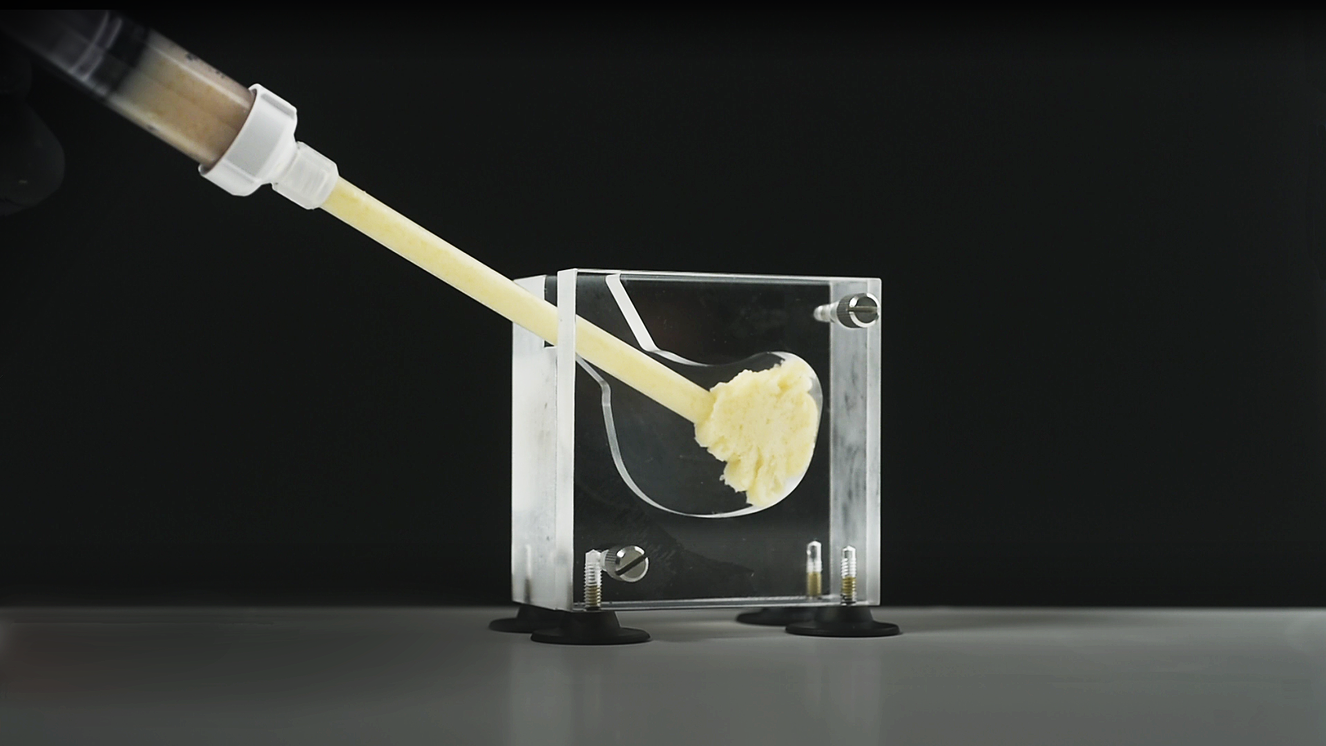 A demonstration of how OSTEOAMP SELECT Flowable can be easily delivered in minimally invasive settings