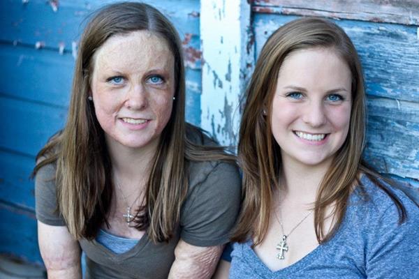 Michelle Lauren, Phoniex Society Fellow and Peer Mentor for the Young Adult Workshop, and her twin sister, Katherine.