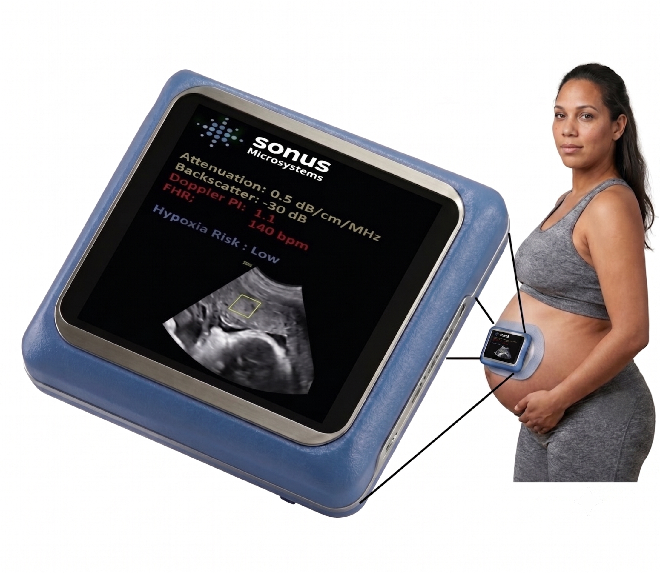 Sonus Patch QUS-P