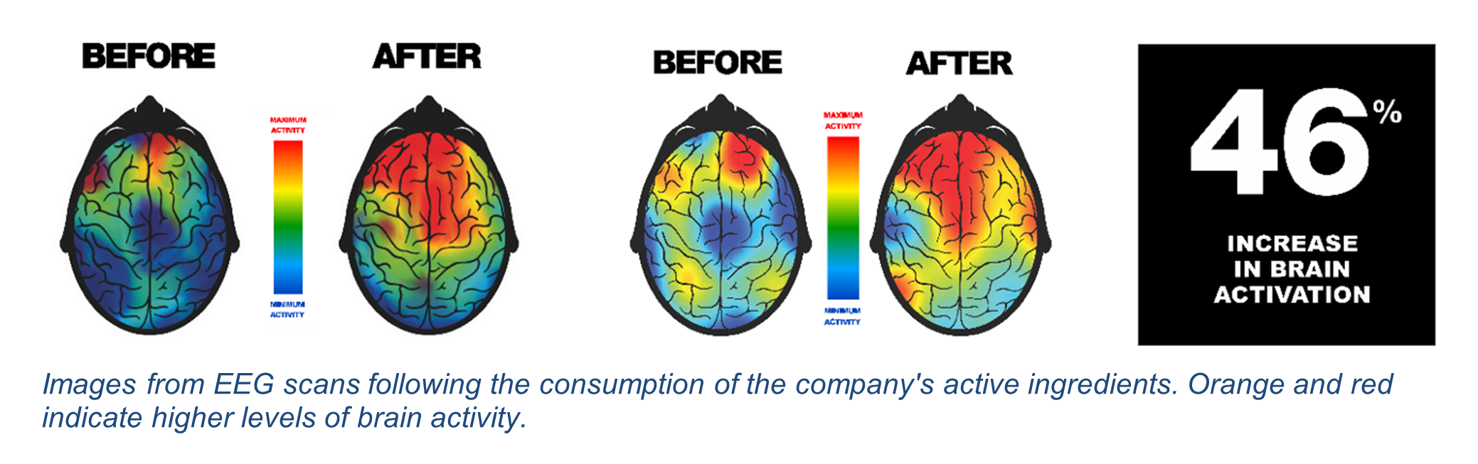 EEG Scans