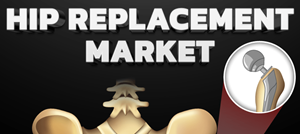 Hip Replacement Market (2023-2030)