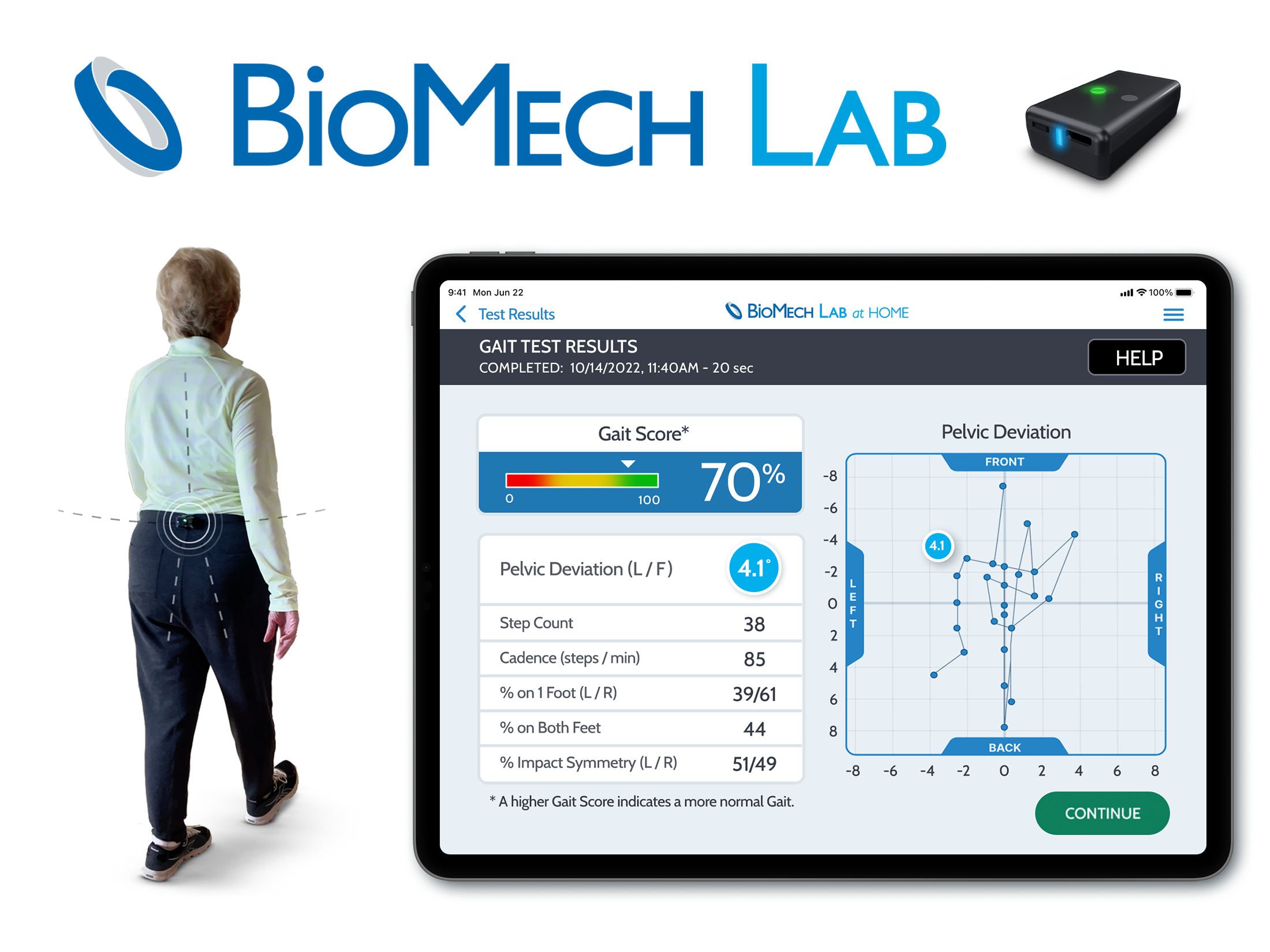BioMech’s motion analytic solution, BioMech Lab, is driven by a proprietary AI engine that ingests motion data from their proprietary sensors to produce highly accurate, precise, and reproducible analyses.