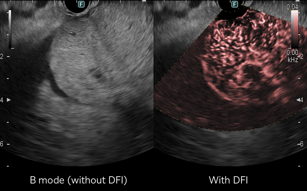 DFI Clinical Image (1)