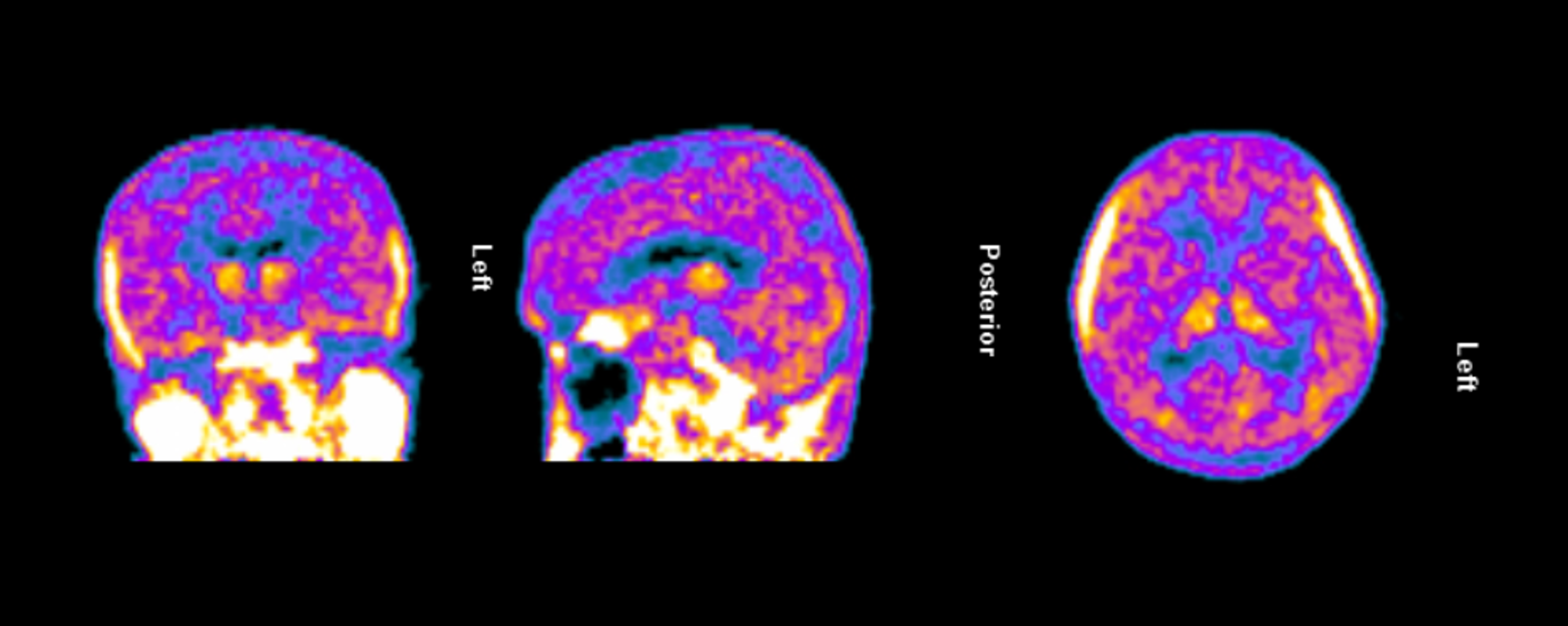 Tiziana Life Sciences, Ltd.