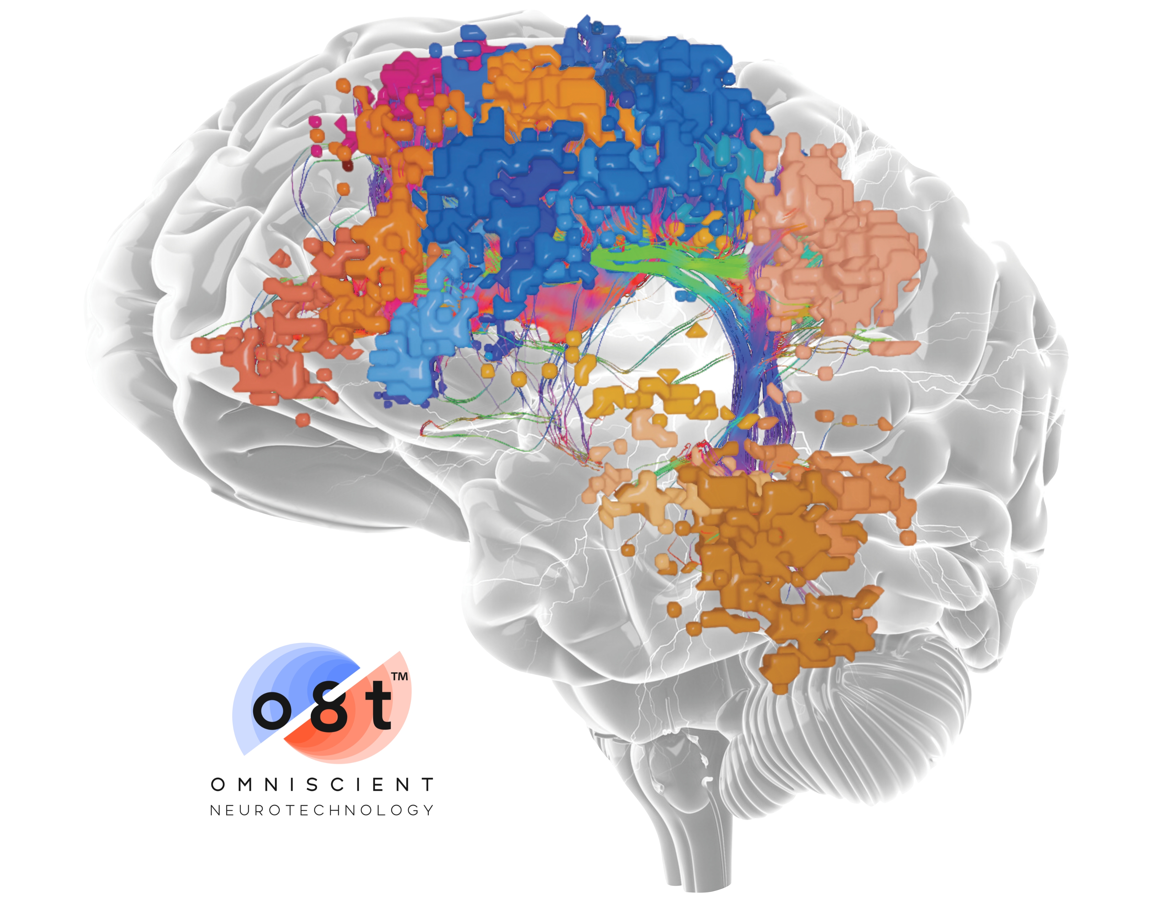 Omniscient’s revolutionary platform, Quicktome®, leverages AI and the groundbreaking study of connectomics to convert a standard MRI scan into a personalized map of an individual’s brain networks.