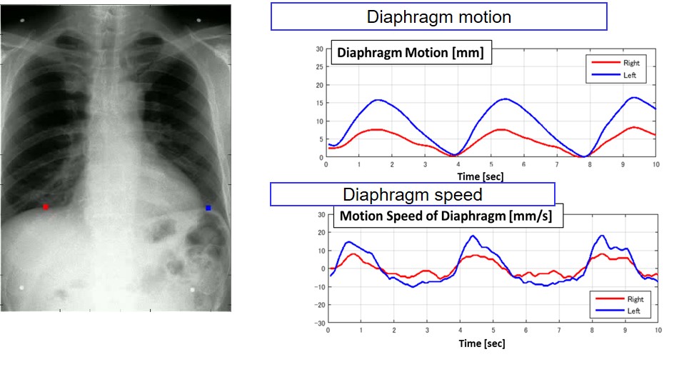 Dynamic Digital Radiography