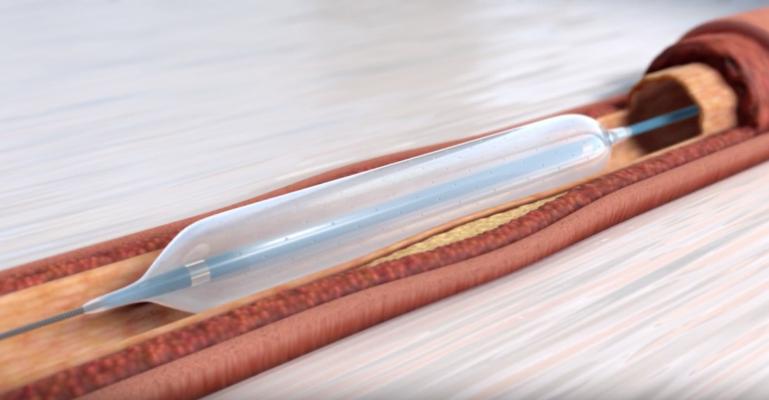 2019-06-13 -- OBIO -- Partnership with Terumo  -- FINAL