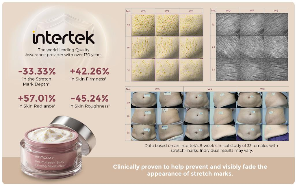 Momcozy Launches Clinically Tested Skincare Solutions for Breast and Belly Care