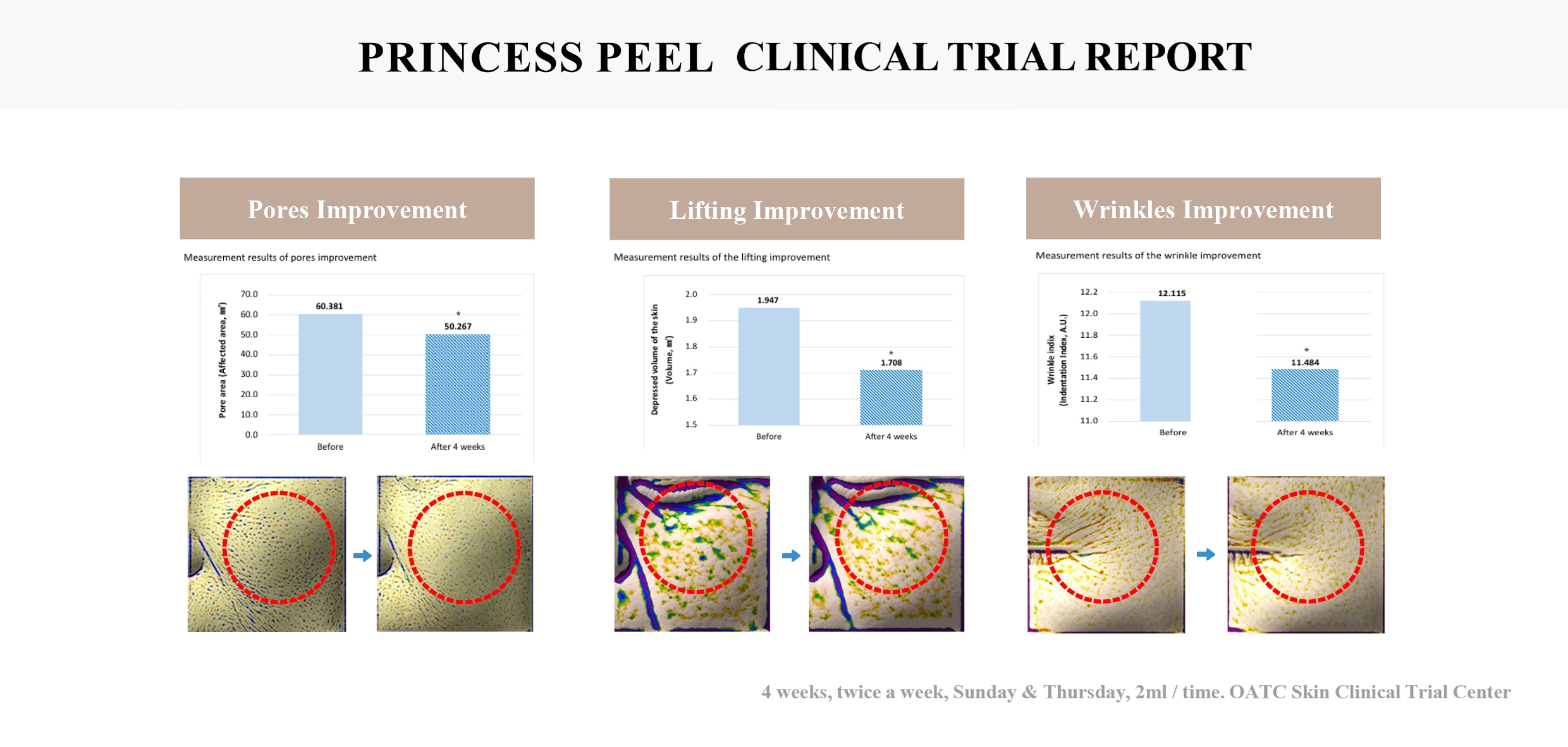 Clinical Trial Report