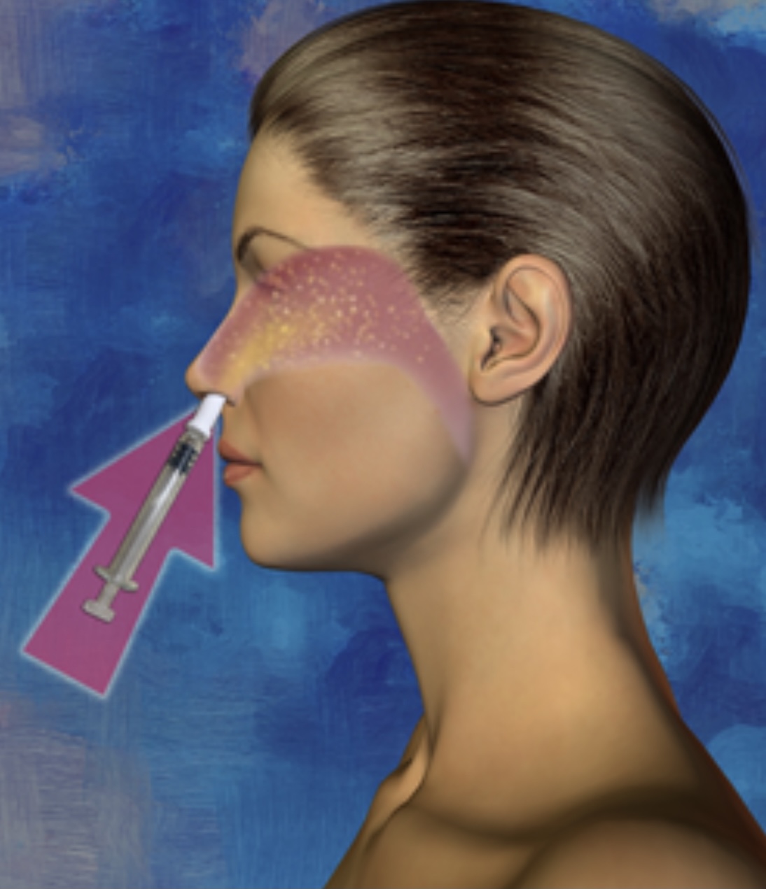 A visual of Ampligen as an intranasal therapy