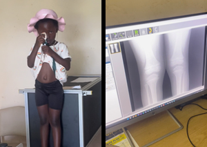Small girl at Rusitu Mission Hospital, Zimbabwe having her hurt knees x-rayed