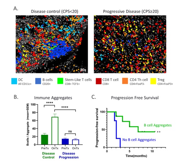 Figure 1. Treatment with pepinemab in combination with KEYTRUDA appears to induce formation of highly organized lymphoid structures in tumors that correlate with disease control.