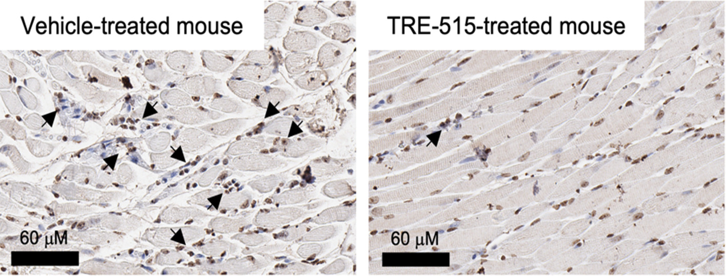 Representative stained sections of the optic nerve from mice. Arrows point to regions of leukocyte infiltration.